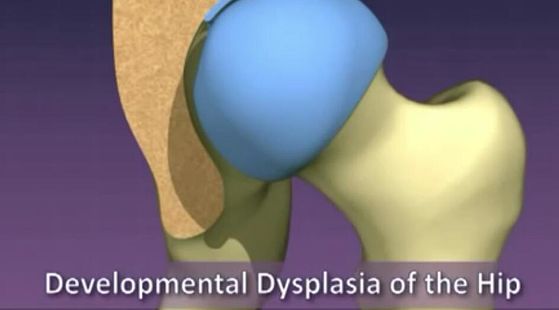 添翼ISPN/RN專業(yè)課43章&nbsp;兒童骨科疾病